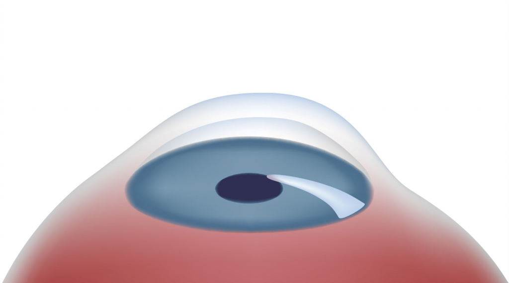 normal eye